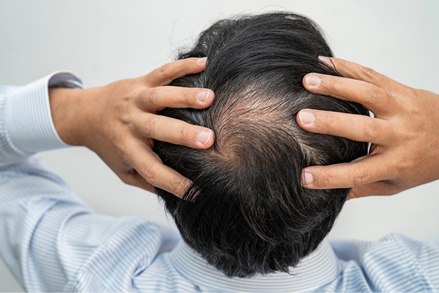 How To Reverse Hair Loss From Stress